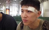 刘晓宇：缝了几针伤无大碍！不确定下场打不打