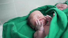 刚出生的两个新生儿排排放，右边宝宝懵懵的，真招人喜欢啊