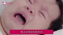 宝宝湿疹很常见，但这4种情况可能要引起重视，家长别粗心忽视了