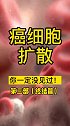 很多人没见过的癌细胞扩散过程，场面震撼！第三部（终结篇）健康