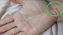 手腕是纳财之地，此处有痣，财源广进