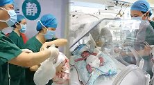 24岁产妇早产1女4男5胞胎 ：体重最大1.4公斤