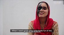 印度少女27岁无人愿娶，只因脸上有神秘印记，令人惋惜
