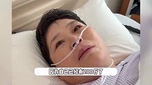 知名脱口秀演员自曝太重压伤膝盖，为健康做减重手术，切了一部分胃和小肠