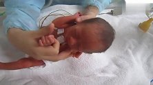 六天大的早产儿，早上醒来是这个样子的，好可爱啊！