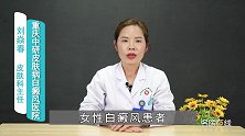 女性白癜风用什么化妆品