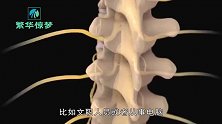 3D动画还原腰椎间盘突出治疗过程，隔着屏幕看得咧开了嘴