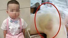 福建5岁男孩被后妈虐打致死 嫌疑人已被刑拘
