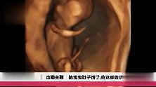 孕产：胎儿肚子饿了就会以这种方式提醒妈妈要吃东西了，十分可爱