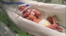 九天大的早产儿，保温箱里挂吊床，躺在上面好可爱啊！