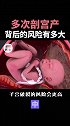 剖宫产尽量不超过3次“不是医学技术上做不到，而是风险太大” 剖腹产  女性  生娃  胎儿  健康