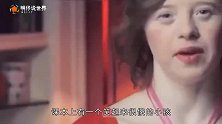 为什么唐氏综合症患者，几乎都长得一模一样原因让人心疼