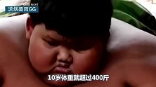 世界上最胖的小孩，十岁体重超过400斤，走路都是“奢望”！