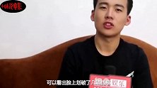郭麒麟拍爆破戏被炸伤，回应令人感动，郭德纲教育出了一个好儿子