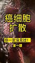 很多人没见过的癌细胞扩散过程，场面震撼！第一部健康