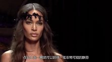 女子患有白癜风，被人们嘲笑为“奶牛”如今却成为世界超模