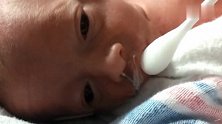 妈妈用棉签湿润28周早产儿的嘴唇，宝宝轻轻的舔着，惹人怜爱