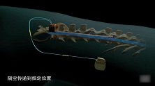 让“大脑”让瘫痪六天恢复行走能力，这技术发展大有可为！