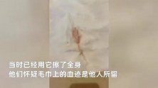 女子用酒店毛巾擦完全身发现不明血迹，担心有艾滋报警，店方：不清楚谁的血