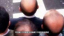 我国脱发人群超2.5亿，6人中就有1人脱发，其实4行为是祸根