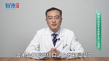 胆结石微创手术后多久可以洗澡？