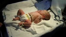 生活百科大全：从肚子里抱出来的宝宝，肚子上还连着脐带！