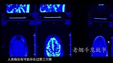 第52期：二郎神的第三只眼每个人都有？揭秘人体“天眼”消失之谜！