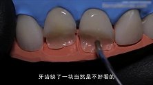人类太会享受了，这补牙过程看着都高级，厉害了我的牙