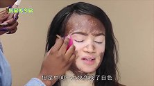 国外美女因白癜风毁容，化妆师给她画个妆，她开心的笑了