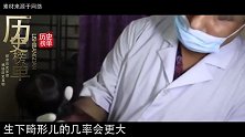 印度男婴患有早衰症，当地居民说是天才转世