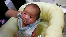 【出生第17天】小宝宝的脸蛋变成这样，必须得去看医生了吗