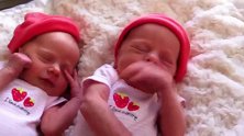 刚出生的双胞胎躺一起，一静一动小巧玲珑，可爱的让人心都融化了