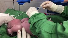 实拍呼吸受阻的新生儿，医生抱去干嘛妈妈们看不到画面