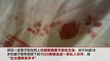 为了新婚夜证明清白 她们买下三无人造处女膜
