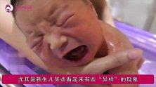 新生儿这2个“异样”，其实是正常现象，新手爸妈别自己吓自己