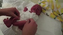 新手爸爸给宝宝换尿布，宝宝好紧张，哭的全身通红！