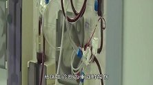 女子全身30多个孔，血液变“酱油色”要7次换血，真凶竟是它？