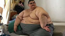世界上最胖的人减重660斤：能抬起胳膊的感觉太好了