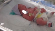 33周早产儿已脱离危险，乖乖地躺在保温箱里，精神充足！