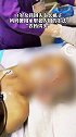 别被“土法”坑了！女儿被妈妈用农药焗头驱虱进icu
