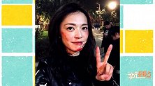 姚晨晒带伤妆自拍超淡定自侃真仙女也会被打