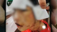 黑龙江4岁女童被虐打进ICU 其生父和“继母”被批准逮捕