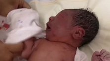 刚出生的8斤4两小宝宝，由于顺产时间太长了，宝宝的脸都憋紫了