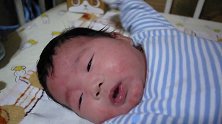 宝宝痱子都长脸上了，细细看更是惹人心疼