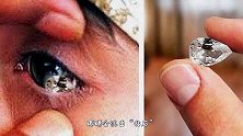印尼姑娘身患怪病！眼睛会流出“钻石”，当地人：美人鱼出处！