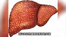“肝病之父”吴孟超，总结数十年养肝经验！做好三件事，对肝脏好
