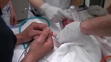 泪目！28周就出生的宝宝要进行紧急输氧，小手紧紧握住爸爸手指