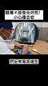髋痛等于股骨头坏死吗？不一定！小心撞击症医学科普 骨科 医者仁心